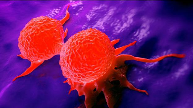 Los casos de cáncer de mama son mucho más comunes a partir de los 20 años de edad.