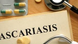 Se estima que la ascariasis afecta a mil millones de personas en todo el mundo. Se estima que la ascariasis afecta a mil millones de personas en todo el mundo.