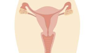 Las mujeres que padecen el síndrome sí tienen ovarios y vulva. Las mujeres que padecen el síndrome sí tienen ovarios y vulva.