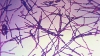 El Pentágono envió paquetes con bacterias de ántrax a 17 estados de EE.UU. y 3 países más