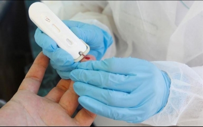 Reportan en el estado una ocupación hospitalaria de 23%, y 27% en camas con ventilador.