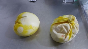 Los implantes mamarios con la cocaína líquida, ya extraidos por la Policía.