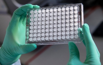 La mayor concentración de casos sospechosos se registra en Guadalajara con 59, Zapopan 47, Tlaquepaque con siete y Tonalá con cuatro.