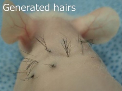 Un ingrediente de las patatas fritas de McDonald's puede ser clave contra la calvicie