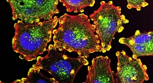 Un tratamiento experimental destruye las células cancerosas sin usar ningún medicamento