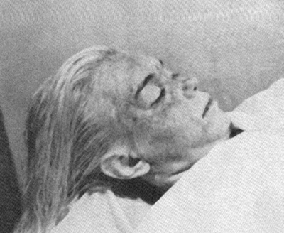 La actriz Marilyn Monroe, en la morgue, en agosto de 1962.