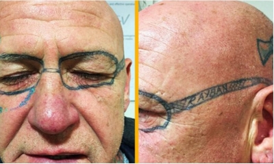 Despertó 'crudo'... ¡y con unos lentes tatuados!