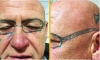 Despertó &#039;crudo&#039;... ¡y con unos lentes tatuados!