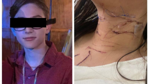 Erik "N" y las heridas causadas a Mya.