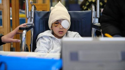 Malek Isa, niño palestino que perdió un ojo por el disparo de una bala con punta de goma.