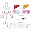 Estas bacterias intestinales producen su propio alcohol y dañan los hígados de las personas que no beben