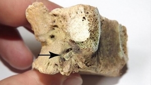 La punta de flecha debería haberle matado, pero su hueso consiguió «regenerare» a su alrededor