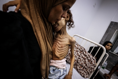 Maryam Duvvas, de 9 años, en estado crítico por desnutrición