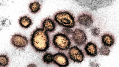 Imagen de microscopio del SARS-CoV-2, el coronavirus que causa el covid-19.