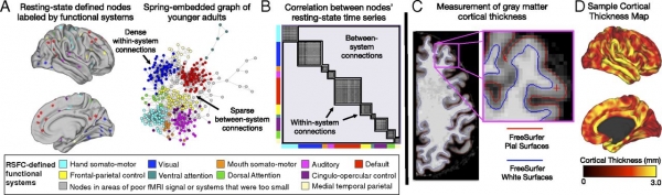 Descubren que el nivel de ingresos de una persona está relacionado con la anatomía de su cerebro