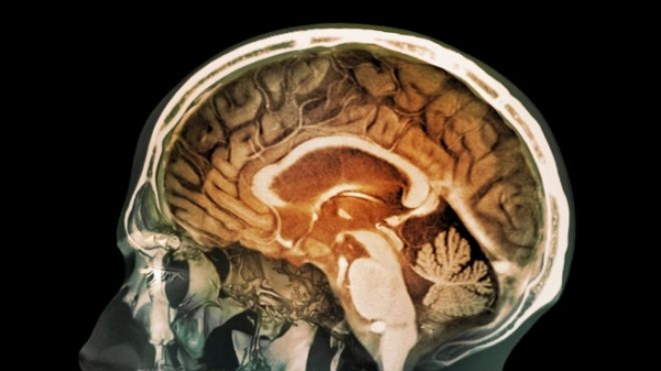 Es la primera vez que se encuentra evidencia de que partículas de la contaminación pueden llegar al cerebro. 