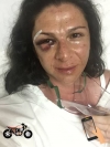 Imagen tuiteada por la senadora Ana Gabriela Guevara luego de ser agredida la noche del domingo pasado