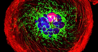 Científicos rusos y finlandeses crean 'nanogranadas' anti-cáncer