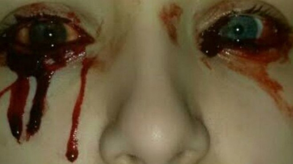 El problema comenzó hace dos años cuando tosió algo de sangre. Después fueron sus ojos y sus oídos.