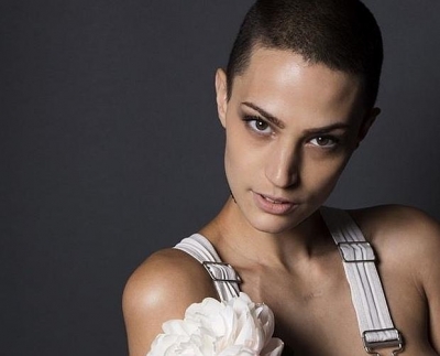 La joven de 25 años con cáncer que se convirtió en una modelo internacional