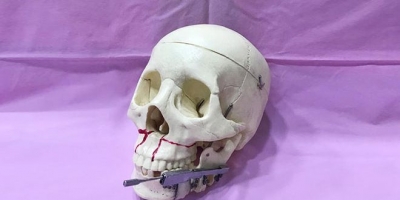 Médico sirio logra patente en cirugía maxilofacial