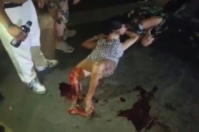 Una mujer herida durante un accidente en el Aca Moto