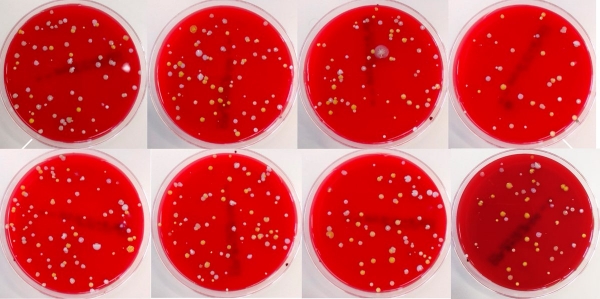 Esta es una pequeña parte de las bacterias que salpican nuestro baño