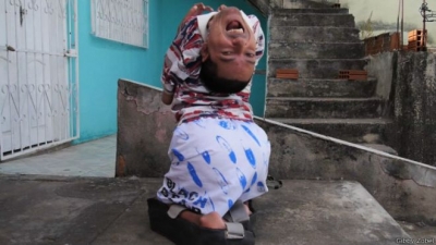 A pesar de sus limitaciones físicas, de Oliveira se graduó como contador y viaja por todo el mundo dando conferencias.