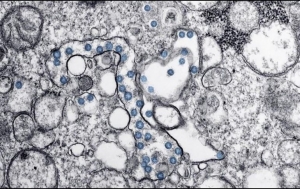 Hallan forma de debilitar la infección del coronavirus