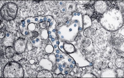 Hallan forma de debilitar la infección del coronavirus