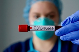 Prueba de coronavirus.
