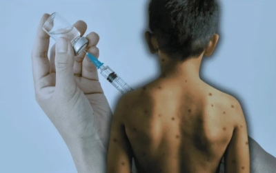 Para prevenir contagios, se están desplegando campañas de vacunación en las escuelas, las cuales han tenido buena respuesta.