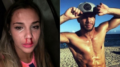 La actriz Magga Bracoviche denunció por golpes a bailarín de Ricky Martin