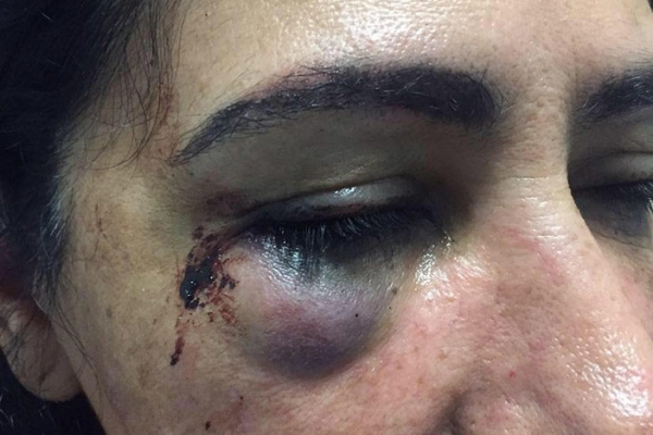 La agresión contra Rosa Margarita Ortiz Macías.