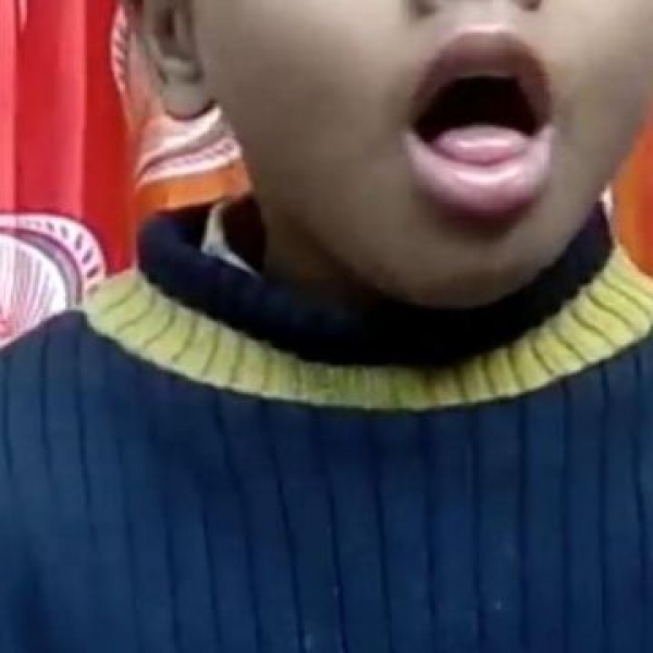 Niño se traga silbato y se escucha al toser: VIDEO