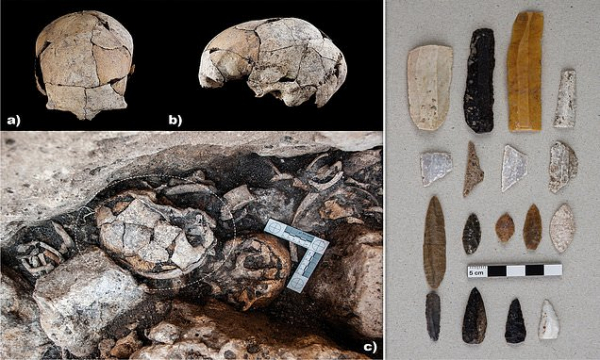 Descubren un cráneo femenino de hace 5.300 años con los primeros indicios conocidos de una cirugía de oído