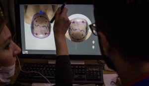 Doctores evalúan a un paciente en una clínica turca.