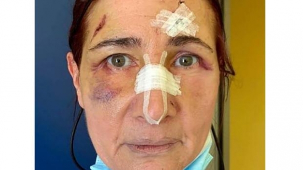 En la imagen Stefania Buonpensiero, víctima de la agresión