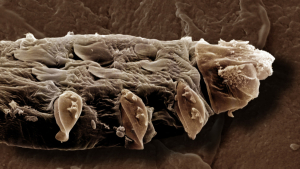 Un ácaro 'Demodex folliculorum'