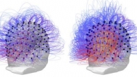 Estos dos escáneres muestran la actividad cerebral del paciente en estado vegetativo antes (izquierda) y después (derecha) del tratamiento