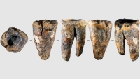 Neandertales contra el caries: encuentran la evidencia más antigua conocida de un tratamiento dental invasivo