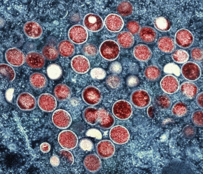 Micrografía electrónica de transmisión coloreada de partículas de viruela del mono (rojo) encontradas dentro de una célula infectada (azul) cultivadas en laboratorio en el Centro de Investigación Integrada (IRE, por sus siglas en inglés) del Instituto Nacional de Alergias y Enfermedades Infecciosas (NIAID, por sus siglas en inglés) , en Fort Detrick, Maryland. 